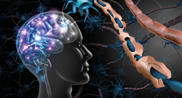 Particularité de la SEP progressive en médecine physique et kinésithérapie approche des phases débutantes et évoluées