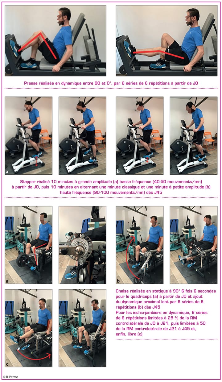 La ligamentisation à l'épreuve de la laximétrie GNRB®