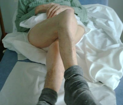 Les hypertonies déformantes acquises des membres des personnes âgées