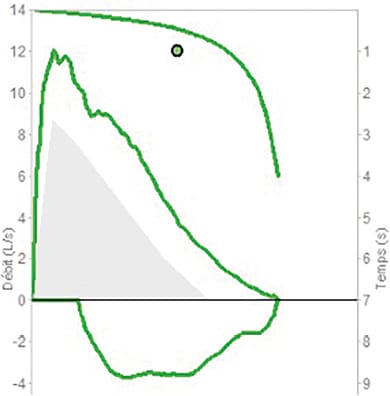 Les débitmètres de pointe
