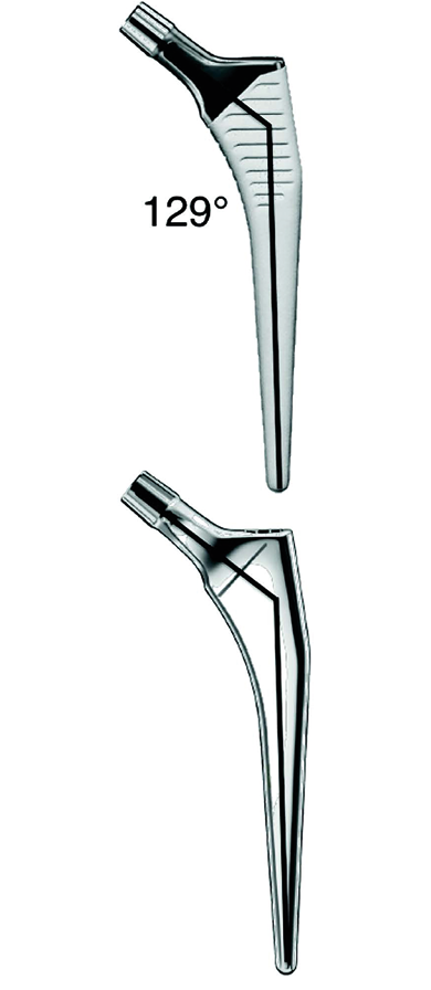 Planification de la prothèse totale de hanche : limites de la radiographie et apport du scanner