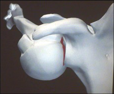 Prise en charge des lésions osseuses humérales dans l'instabilité d'épaule