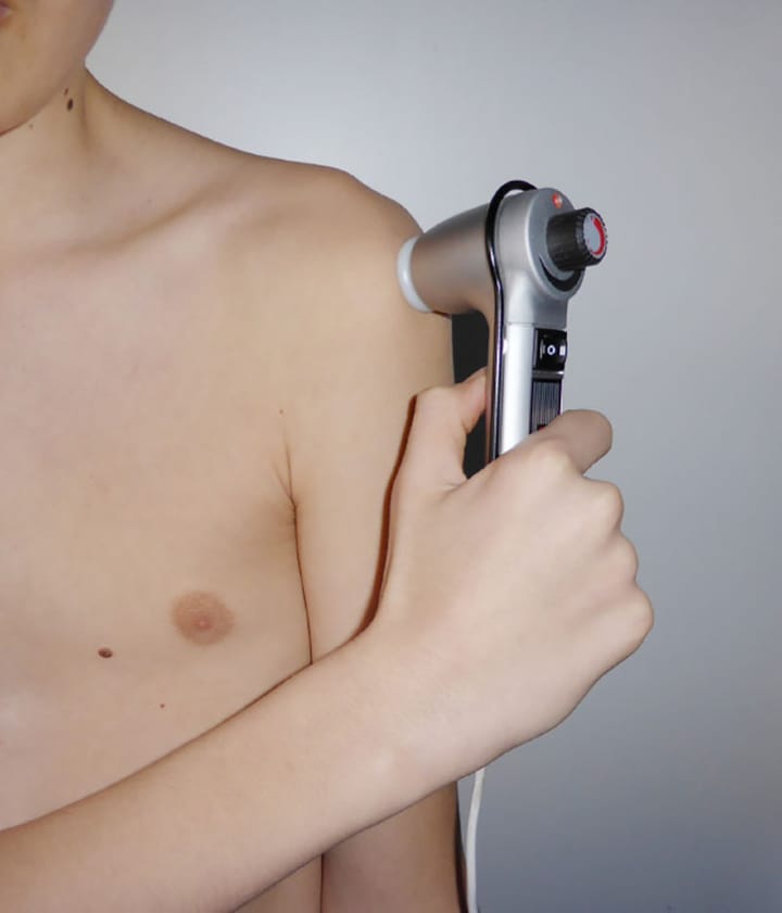 Quelles physiothérapie dans les tendinopathies ?