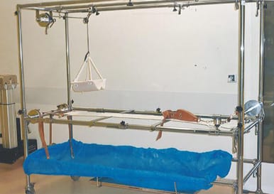 Séries de plâtres d'élongation, dérotation et flexion (EDF) chez des patients présentant une scoliose à début précoce