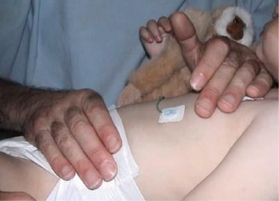 Erreurs et remédiations possibles dans le raisonnement clinique dans l'exercice de la masso-kinésithérapie : l'exemple de la bronchiolite du nourrisson