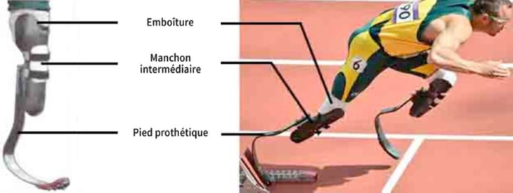Zoom sur les prothèses bioniques