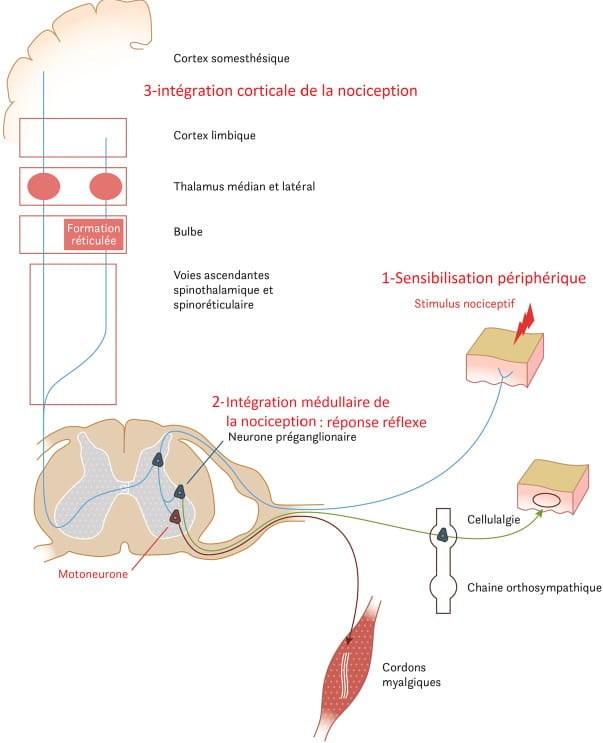 Intérêt du massage neural® dans le traitement des algies pelvi-périnéales