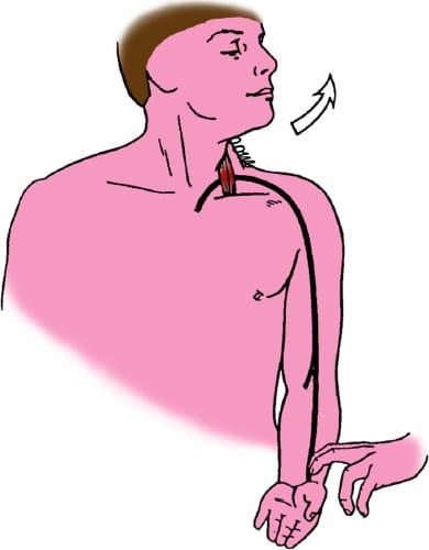 Description des tests de compression thoraco-brachiale (1ère partie)