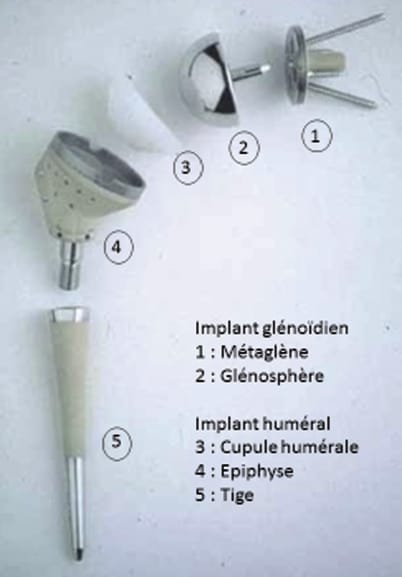 Rééducation postopératoire des arthroplasties inversées d'épaules