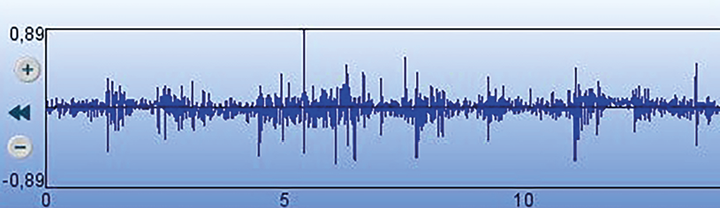 L'auscultation pulmonaire électronique