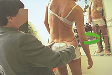 Neurostimulations manuelles et lombosciatique : apport de la Posturothérapie NeuroSensorielle (PNS)