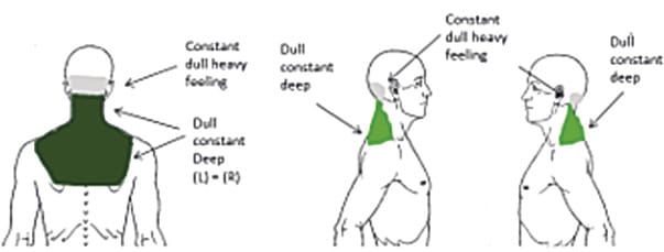 Le diagnostic différentiel des vertiges