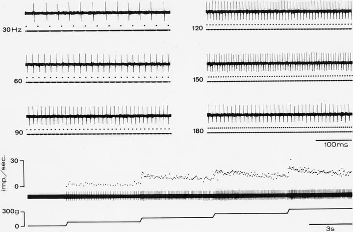 Stimulation vibratoire transcutanée : effets sur la douleur