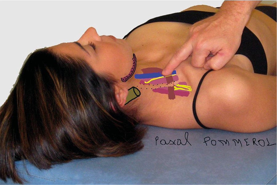 Sensibilisation (ou hypersensibilisation) centrale : une révolution pour la thérapie manuelle et la kinésithérapie. Concepts, diagnostic et principe de traitement